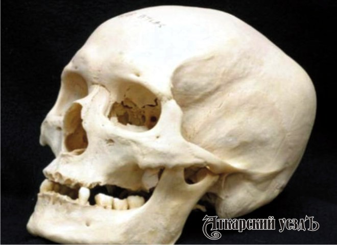 В Елизаветино Аткарского района обнаружен скелетированный череп человека