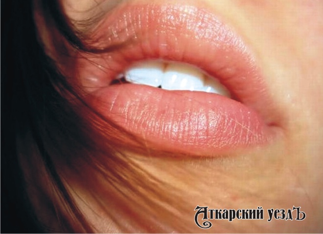 Ученые выяснили, какие губы у женщин идеальны
