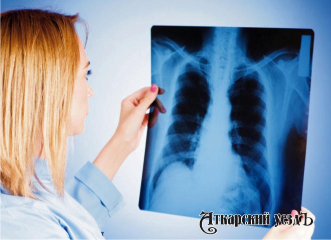 Восемь жителей Аткарска заболели туберкулезом легких